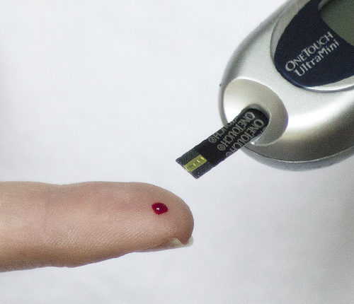 Diabetologo